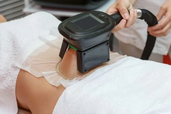 Image of person having fat freezing treatment to help weight gain Ryton on Dunsmore