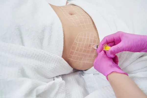 image of fat dissolving injections on love handles to help combat weight gain Ryton on Dunsmore