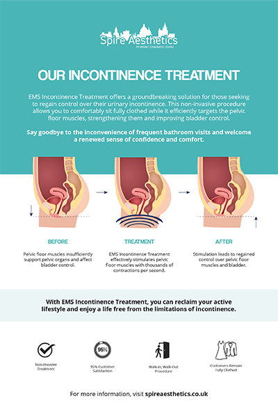 image to show how EMS treatment works for female urinary incontinence Ryton on Dunsmore
