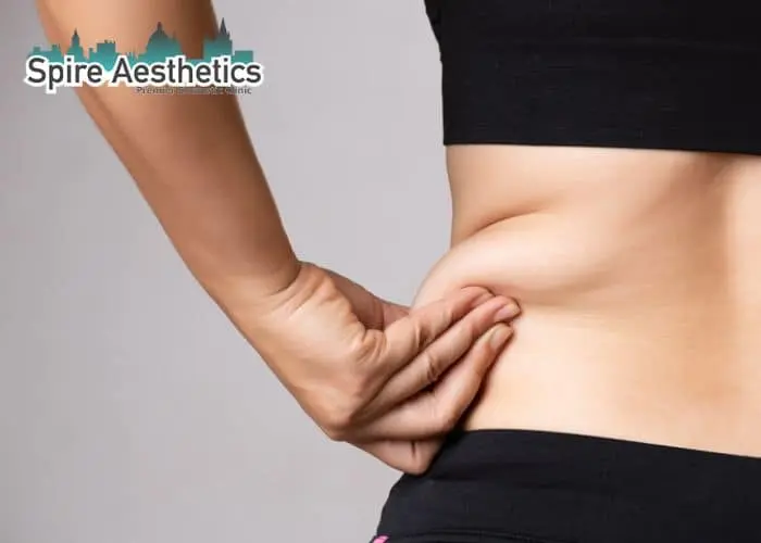 Image of woman pinching fat on their hips Ryton on Dunsmore. Fat Freezing treatment