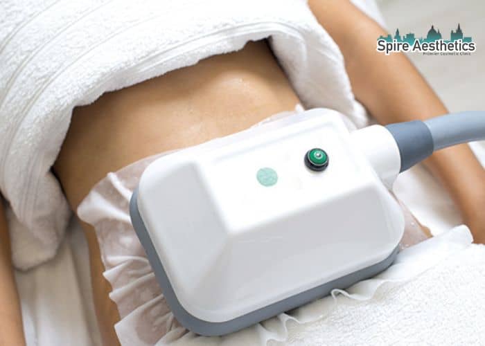 Shift Those Extra Pounds: How Fat Freezing Can Help You Slim Down Ryton on Dunsmore