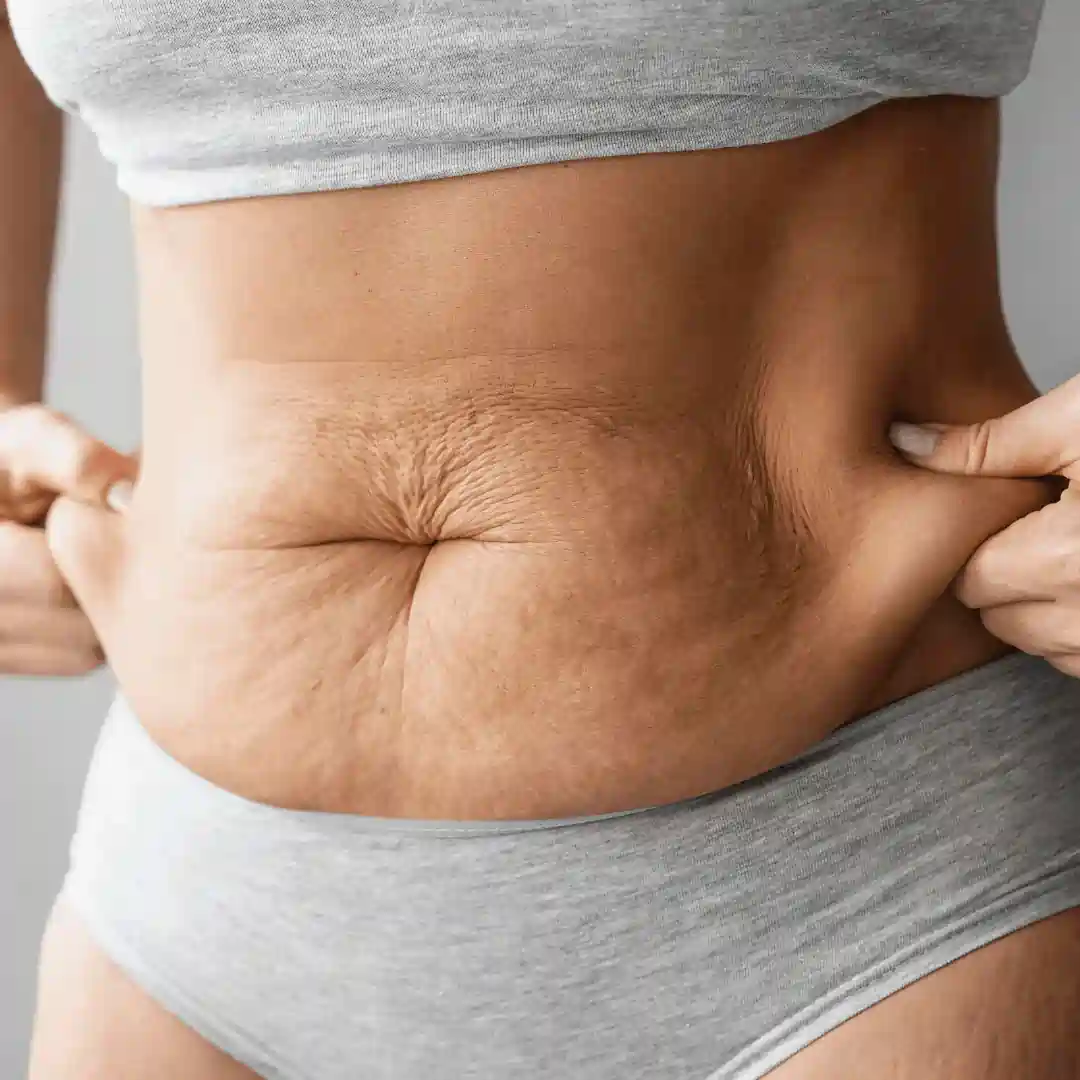 Is It Normal to Have Loose Skin After Pregnancy Ryton on Dunsmore?