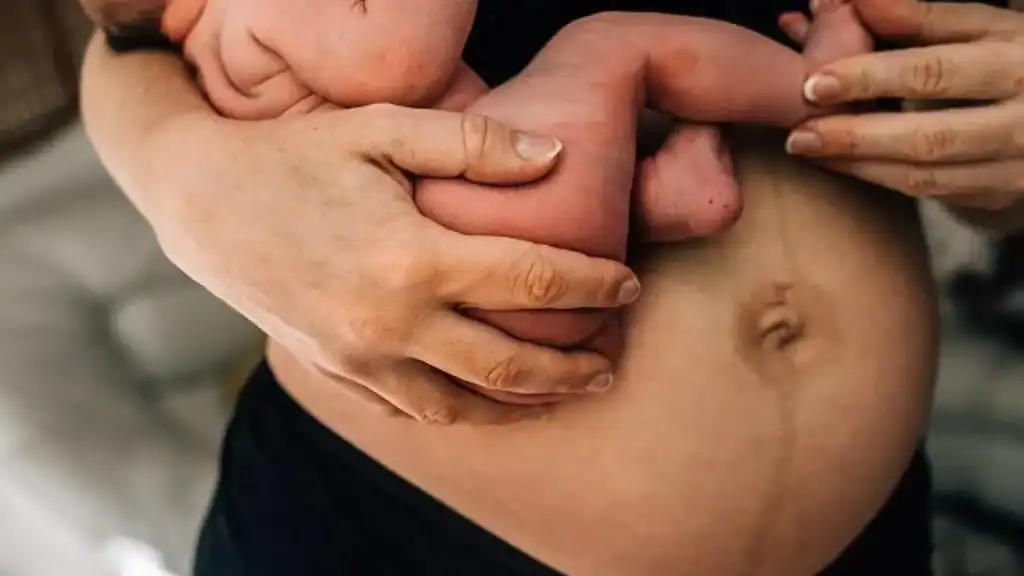 Why Is My Stomach Still Big After Pregnancy Ryton on Dunsmore?
