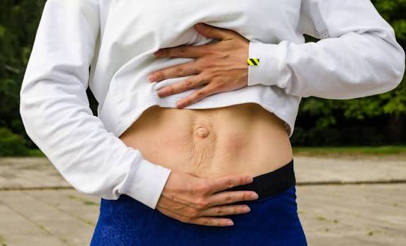 When Could Diastasis Recti Be the Missing Piece of the Puzzle Ryton on Dunsmore?